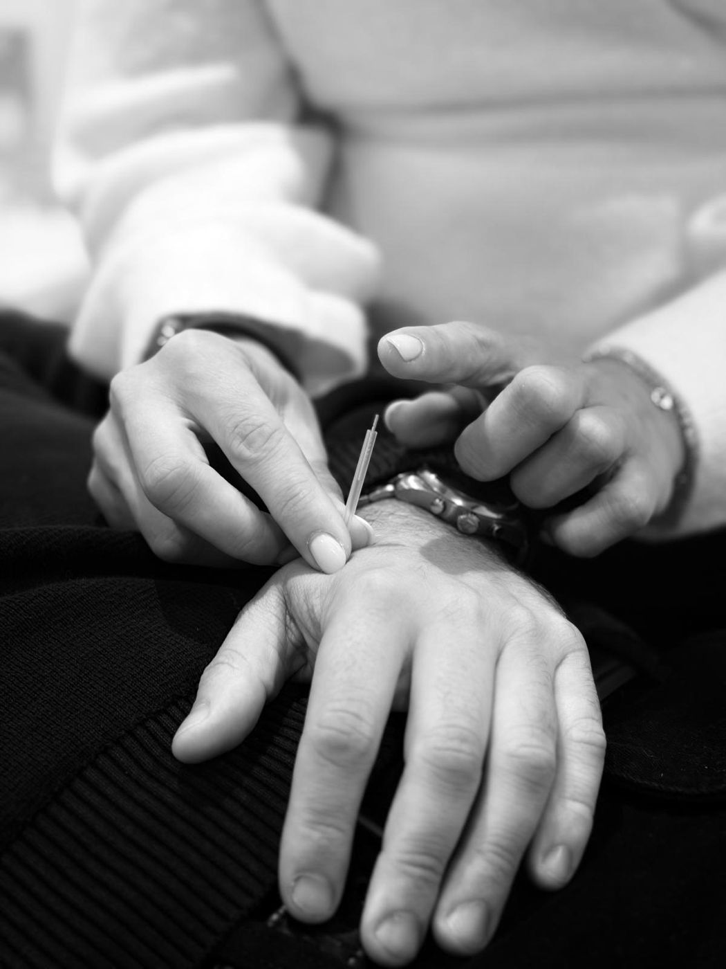 Close-up of a fine acupuncture needle being placed on a wrist